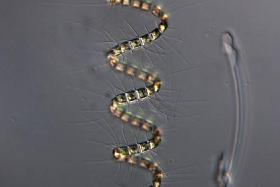 Live chain of the diatom Chaetoceros debilis